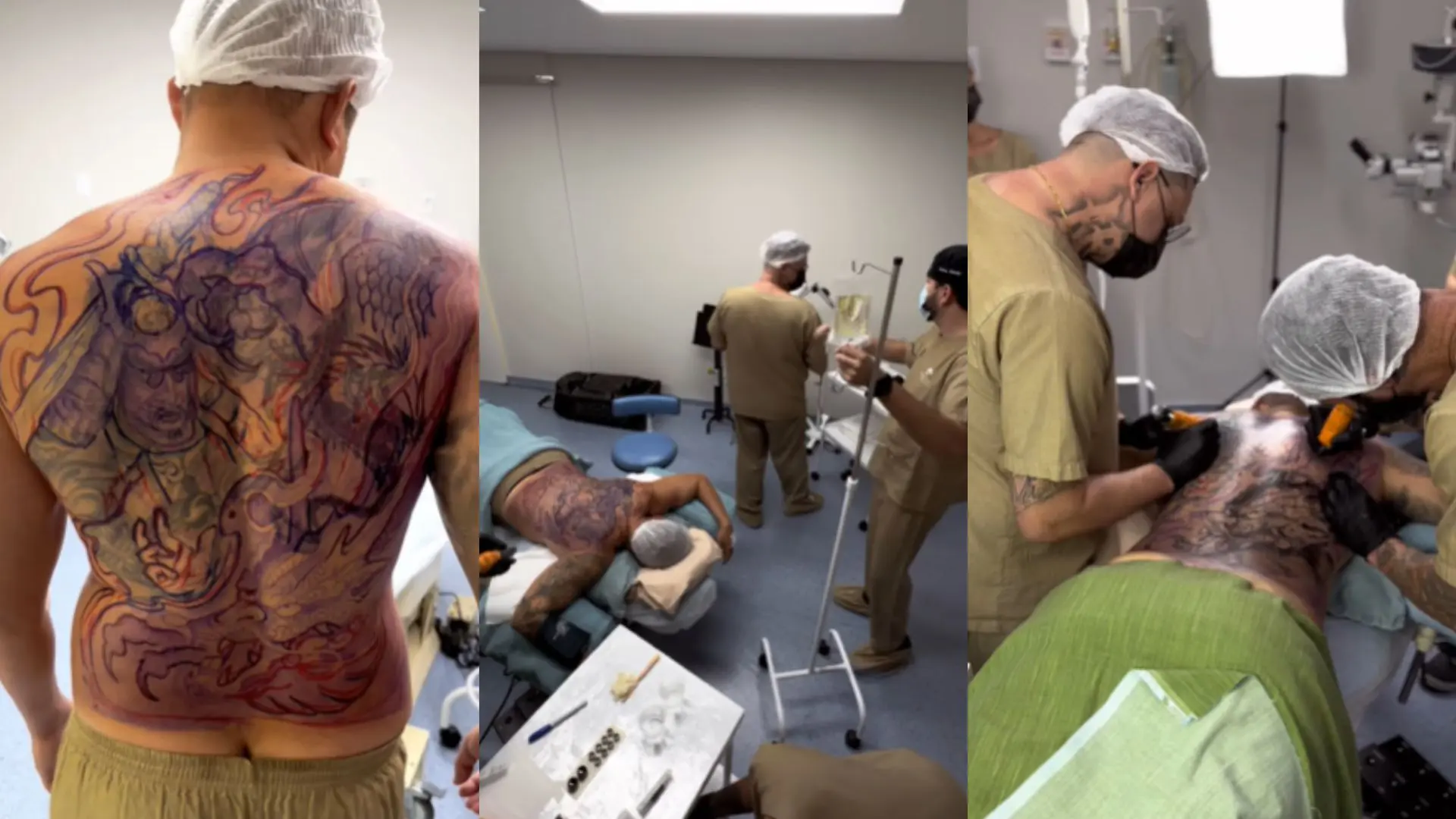 Sob sedação e com acompanhamento médico, um campo-grandense realizou uma tatuagem que "fechou" suas costas por inteiro esta semana. O procedimento durou 13 horas e foi realizado no Centro Cirúrgico do