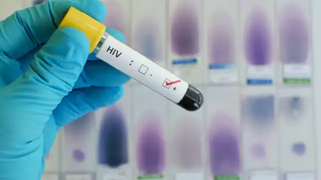 Mulher diz que laboratório investigado entregou exame com falso positivo para HIV no parto