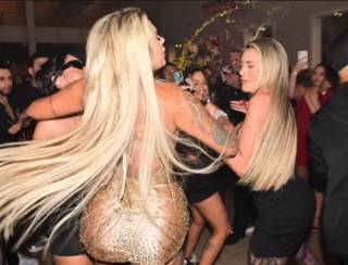 Andressa Urach é agredida em festa e leva 4 pontos no rosto