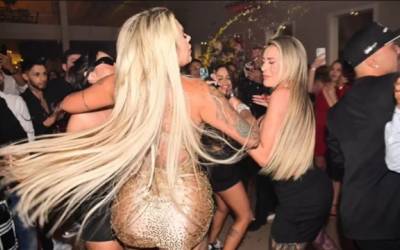 Andressa Urach é agredida em festa e leva 4 pontos no rosto